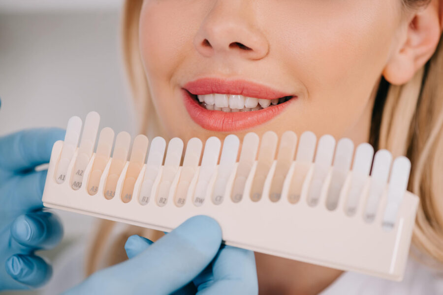 patient choosing shade for teeth whitening in coral springs